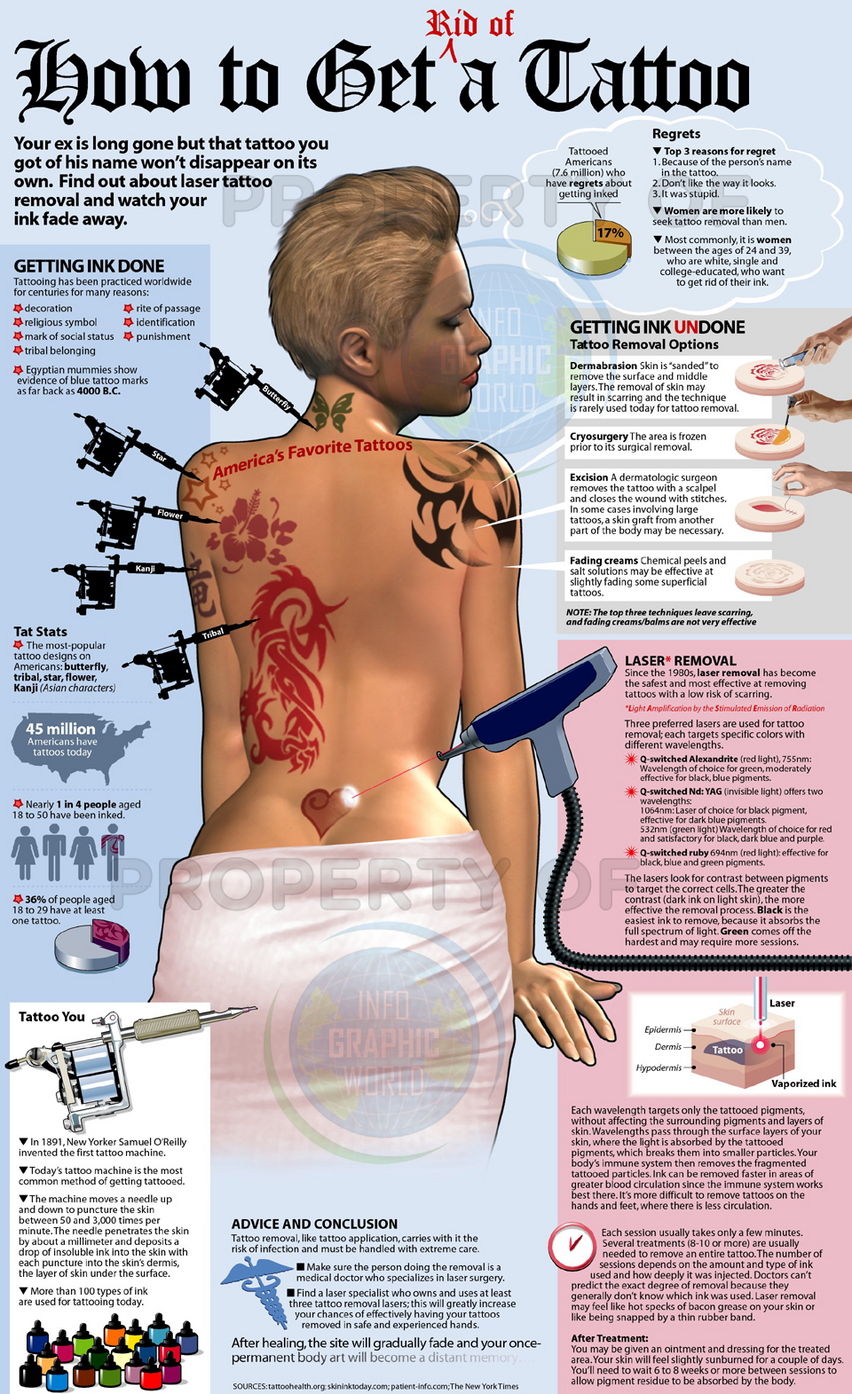 Guide to Tattoo Removalpoop Guide to Tattoo Removal